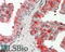 Sterol O-Acyltransferase 1 antibody, 42-494, ProSci, Enzyme Linked Immunosorbent Assay image 