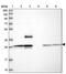 Matrix Remodeling Associated 7 antibody, PA5-60840, Invitrogen Antibodies, Western Blot image 