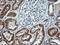 Acetyl-CoA Acyltransferase 2 antibody, LS-C174713, Lifespan Biosciences, Immunohistochemistry paraffin image 