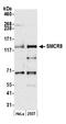 SMCR8-C9orf72 Complex Subunit antibody, A304-694A, Bethyl Labs, Western Blot image 