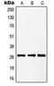 PTTG1 Regulator Of Sister Chromatid Separation, Securin antibody, orb214880, Biorbyt, Western Blot image 