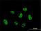 Centromere protein Q antibody, H00055166-M01, Novus Biologicals, Immunocytochemistry image 