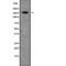 Zinc Finger Protein 608 antibody, abx219469, Abbexa, Western Blot image 