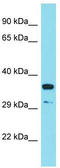 RSPO3 antibody, TA343018, Origene, Western Blot image 