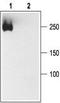 Sodium channel protein type 1 subunit alpha antibody, TA329029, Origene, Western Blot image 