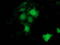 BCAR1 Scaffold Protein, Cas Family Member antibody, LS-C172803, Lifespan Biosciences, Immunofluorescence image 