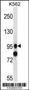 SID1 Transmembrane Family Member 1 antibody, 57-088, ProSci, Western Blot image 