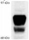 Nuclear Receptor Subfamily 3 Group C Member 1 antibody, ab3581, Abcam, Western Blot image 