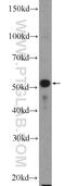 PLAG1 Like Zinc Finger 1 antibody, 25864-1-AP, Proteintech Group, Western Blot image 