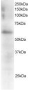 FGR Proto-Oncogene, Src Family Tyrosine Kinase antibody, AHP657, Bio-Rad (formerly AbD Serotec) , Western Blot image 