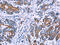 ArfGAP With FG Repeats 1 antibody, CSB-PA030856, Cusabio, Immunohistochemistry paraffin image 