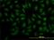 Decapping Enzyme, Scavenger antibody, H00028960-M02, Novus Biologicals, Immunocytochemistry image 