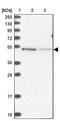 Myb/SANT DNA Binding Domain Containing 2 antibody, NBP1-93931, Novus Biologicals, Western Blot image 