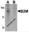 B2M antibody, 7439, ProSci Inc, Western Blot image 