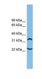 Alpha Tubulin Acetyltransferase 1 antibody, orb325025, Biorbyt, Western Blot image 