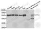 ETS Variant 4 antibody, A5797, ABclonal Technology, Western Blot image 