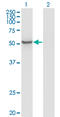 Zinc Finger Protein 70 antibody, LS-C198471, Lifespan Biosciences, Western Blot image 