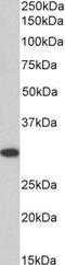ANP32B antibody, GTX89831, GeneTex, Western Blot image 