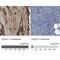 Collagen alpha-1(VI) chain antibody, NBP1-91195, Novus Biologicals, Immunohistochemistry paraffin image 