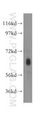 Negative elongation factor D antibody, 11226-1-AP, Proteintech Group, Western Blot image 