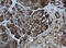 Epoxide Hydrolase 1 antibody, LS-C336974, Lifespan Biosciences, Immunohistochemistry paraffin image 