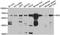 Glucosamine (N-Acetyl)-6-Sulfatase antibody, LS-C349183, Lifespan Biosciences, Western Blot image 