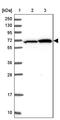 Zinc Finger And BTB Domain Containing 1 antibody, PA5-62203, Invitrogen Antibodies, Western Blot image 