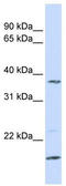 Zinc Finger DHHC-Type Containing 19 antibody, TA335990, Origene, Western Blot image 