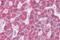 ABCC5 antibody, GTX88691, GeneTex, Immunohistochemistry paraffin image 
