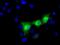 UPF0663 transmembrane protein C17orf28 antibody, MA5-25149, Invitrogen Antibodies, Immunocytochemistry image 