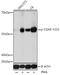 Cyclic GMP-AMP Synthase antibody, GTX03285, GeneTex, Western Blot image 