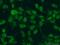 Dachshund Family Transcription Factor 1 antibody, 60082-1-Ig, Proteintech Group, Immunofluorescence image 