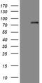 Ald antibody, LS-C793855, Lifespan Biosciences, Western Blot image 