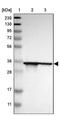 Twisted Gastrulation BMP Signaling Modulator 1 antibody, PA5-53248, Invitrogen Antibodies, Western Blot image 