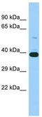 IST1 homolog antibody, TA331969, Origene, Western Blot image 