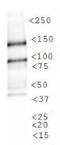 Jhdm2a antibody, NBP1-49601, Novus Biologicals, Western Blot image 