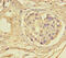 Gasdermin E antibody, A55235-100, Epigentek, Immunohistochemistry paraffin image 