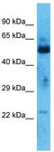 Zinc Finger Protein 772 antibody, TA345569, Origene, Western Blot image 