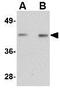 Nanos C2HC-Type Zinc Finger 1 antibody, GTX17010, GeneTex, Western Blot image 