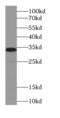 ADAM 17 antibody, FNab00139, FineTest, Western Blot image 