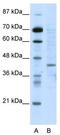 Ring Finger Protein 1 antibody, TA335797, Origene, Western Blot image 