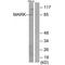 Serine/threonine-protein kinase MARK1 antibody, A04564-1, Boster Biological Technology, Western Blot image 
