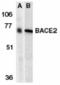 Beta-Secretase 2 antibody, TA306031, Origene, Western Blot image 