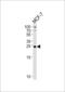 3-Hydroxyacyl-CoA Dehydratase 2 antibody, LS-C162298, Lifespan Biosciences, Western Blot image 