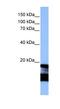 Late Endosomal/Lysosomal Adaptor, MAPK And MTOR Activator 5 antibody, NBP1-79176, Novus Biologicals, Western Blot image 