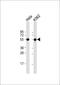 ATPase H+ Transporting V1 Subunit B1 antibody, 55-903, ProSci, Western Blot image 
