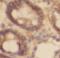 Phospholipase A2 Group VI antibody, FNab04372, FineTest, Immunohistochemistry frozen image 