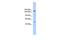 E3 ubiquitin-protein ligase SHPRH antibody, GTX47490, GeneTex, Western Blot image 