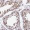 Jupiter Microtubule Associated Homolog 1 antibody, NBP2-32492, Novus Biologicals, Immunohistochemistry paraffin image 
