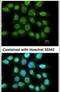 LRAT Domain Containing 1 antibody, PA5-30705, Invitrogen Antibodies, Immunofluorescence image 